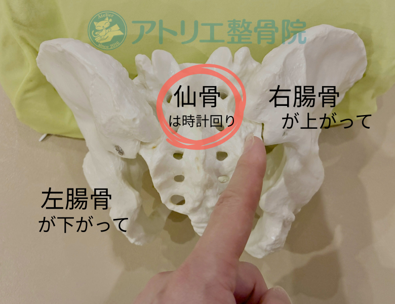 板橋区の整体アトリエ整骨院の骨盤のゆがみL+