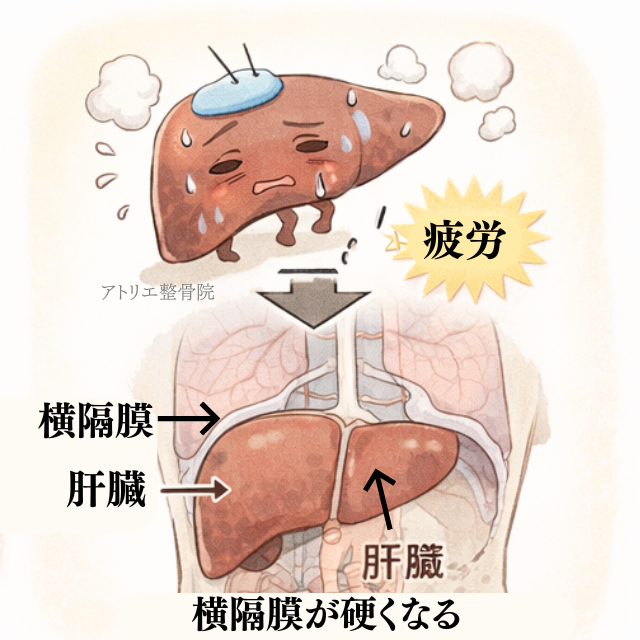 板橋の整体アトリエ整骨院の横隔膜が硬くなるイラスト